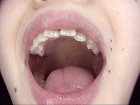 300人のおくち　3　サンプル画像11